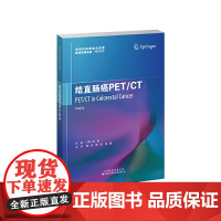 结直肠癌PET/CT