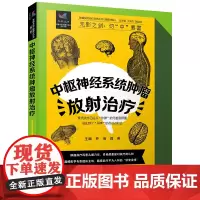 中枢神经系统肿瘤放射治疗 肿瘤放射治疗科普丛书