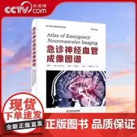 [央视网]急诊神经血管成像图谱 是一部细致 专业的急诊神经血管疾病评估参考书ZK