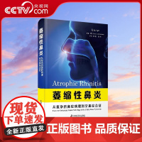 [央视网]萎缩性鼻炎 从复杂的鼻腔病理到空鼻综合征 萎缩性鼻炎的病理生理学 临床特点 诊断评估 等方面ZK DF