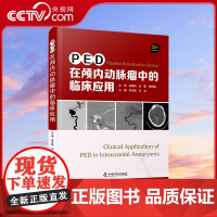 [央视网]PED在颅内动脉瘤中的临床应用 50个典型病例 神经外科临床医学书籍颅内肿瘤动脉瘤外科手术ZK