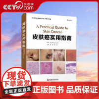 [央视网]皮肤癌实用指南 总结性表格与图片 能帮助读者快速掌握皮肤癌相关知识及治疗方法 ZK