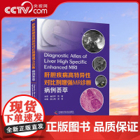 [央视网]肝胆疾病高特异性对比剂增强MR诊断 病例荟萃 国内多位Z影像学专家联合编写本书ZK