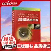 [央视网]微创青光眼手术 (新加坡)凯尔文·C.A.孙,(英)凯斯·巴顿ZK DF