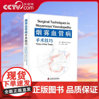 [央视网]烟雾血管病手术技巧 柏林洪堡大学神经外科与儿童神经外科系主任教授领衔 一部详细介绍烟雾血管病手术技巧的实用指南
