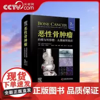 [央视网]恶性骨肿瘤 肉瘤与转移瘤 从基础到临床 原书第3版 国际经典骨科学译著 由骨科专家Dominique Heym