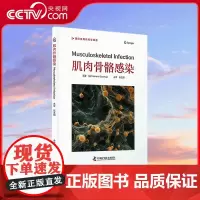 [央视网]肌肉骨骼感染 梅乐妮·科特赫普 著 张文明 译 引进自 Springer 出版社 有关肌肉骨骼感染的实用专著