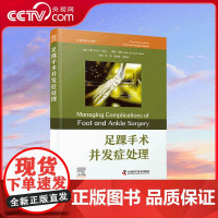 [央视网]足踝手术并发症处理 经典骨科学译著 沈奕 谭文甫 宋德业 踇趾强直手术并发症 ZK