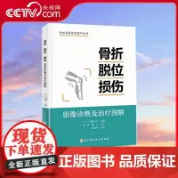 [央视网]骨折脱位损伤 影像诊断及治疗图解 详细分型高清图片视频演示 介绍骨折脱位和损伤的基本知识 检查与诊断方法和治疗