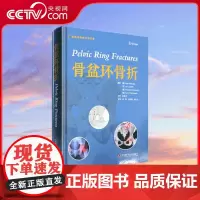 [央视网]骨盆环骨折 欧洲骨科专家编写 国内临床骨科专家翻译 内容丰富新颖 评价客观 文献证据有力 全面介绍骨盆环骨折Z