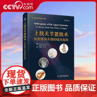 [央视网]上肢关节置换术 从肘部部的临床指南 专门介绍肘部 腕部及手部关节置换术的著作 ZK