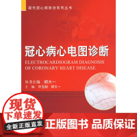 冠心病心电图诊断