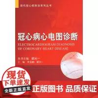 冠心病心电图诊断