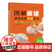 图解拔罐:健体祛病拔罐全书