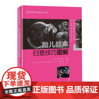 胎儿超声扫查技巧图解 胎儿 超声 扫查 技巧 北京科学技术