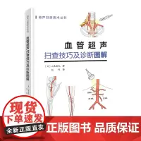 血管超声扫查技巧及诊断图解 日本持续 超声扫查技术丛书 血管解剖—扫查方法—诊断要点 一看就明白准确操作 抓住诀窍