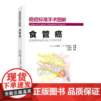 癌症标准手术图解.食管癌 国际顶尖肿瘤医院标准手术流程完美重现 系统阐述食管癌手术的基本手术方法、技术精华