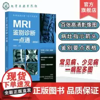 影像鉴别诊断一目了然系列 MRI鉴别诊断一点通 第四版 常见病少见病 一病配多图 病灶指示箭头 表格鉴别要点 影像科医生