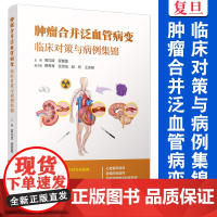 肿瘤合并泛血管病变:临床对策与病例集锦 葛均波,程蕾蕾 肿瘤学-临床医学-病例集锦 复旦大学出版社