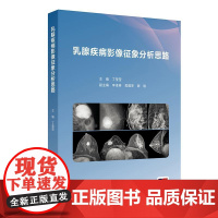 乳腺疾病影像征象分析思路