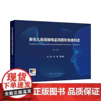 新生儿连续脑电监测图形快速判读(第2版)