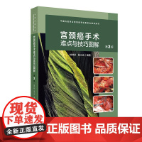 宫颈癌手术难点与技巧图解第2版林仲秋张三元妇产科妇科肿瘤经腹损伤2024NCCN指南低危保守性常见手术诊疗经典授课视频解
