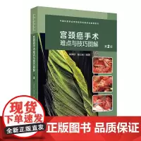 宫颈癌手术难点与技巧图解第2版林仲秋张三元妇产科妇科肿瘤经腹损伤2024NCCN指南低危保守性常见手术诊疗经典授课视频解