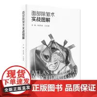 面部除皱术实战图解