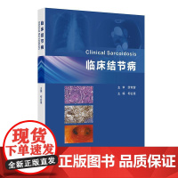 临床结节病 2024年12月参考书