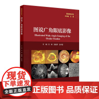 图说广角眼底影像文峰张雄泽吉宇莹视网膜病变眼底炎症感染遗传性玻璃体人民卫生出版社影像诊断学专业眼科医师参考工具书临床全彩