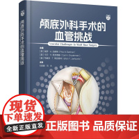 颅底外科手术的血管挑战 颅底血管解剖肿瘤累及血管评估栓塞**血管搭桥技术等刘宏毅