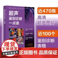 超声鉴别诊断一点通 影像鉴别诊断一目了然系列 刘艳君、马春燕 主编 化学工业出版社