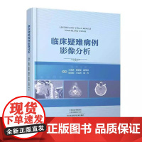 [正版全新]临床疑难病例影像分析 9787572513817