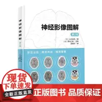神经影像图解(第2版)脑部影像功能障碍脑梗死脑出血影像脑萎缩痴呆缺血性脑血管病头部外伤脑部影像特征阅片诀窍9787571