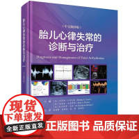 胎儿心律失常的诊断与治疗