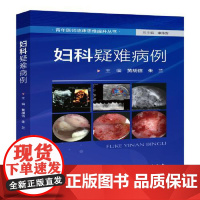 妇科疑难病例 黄胡信 朱兰 妇科肿瘤先天性发育异常感染及创伤性疾病诊疗疑难病例分析妇科各级临床医师妇幼保健及小儿妇科医师