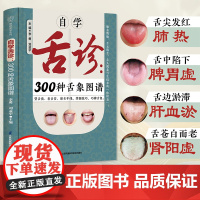自学舌诊:300种舌象图谱