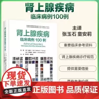 肾上腺疾病临床病例100例 张玉石 童安莉主译 基于病例的方法来评估和治疗常见和不常见的肾上腺疾病 中国协和医科大学出版