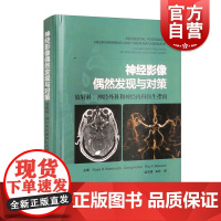 神经影像偶然发现与对策--放射科、神经外科和神经内科医生指南