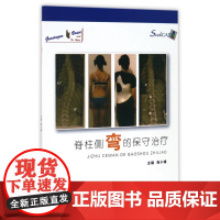 脊柱侧弯的保守治疗