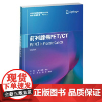 前列腺癌PET/CT
