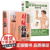 [2册]罐到病除对症拔罐祛百病+常见病对症拔罐速查手册 书籍