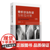 骨折诊治失误分析及对策 第2版 张根民 病史采集中的失误 对骨折的严重并发症重视不够 石膏固定不当的分析及对策人民卫生出