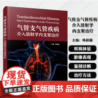 气管支气管疾病介入放射学内支架治疗 韩新巍主编中国抗癌协会肿瘤介入学副主任委员 经典介入医学著作 中国科学技术出版社