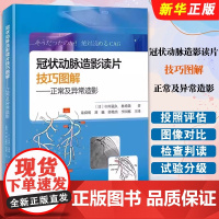 [正版书籍]冠状动脉造影读片技巧图解 正常及异常造影 教你从冠脉造影小白 快速进阶PCI达人 北京科学技术出版社书籍