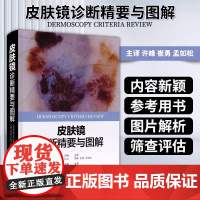 皮肤镜诊断精要与图解 涉及病例数多达105例 图片为主 细致的分析 皮肤科医学书 皮肤镜诊断图谱 皮肤镜标准综述 皮肤病