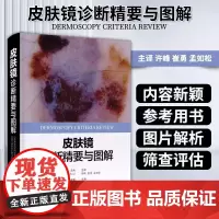 皮肤镜诊断精要与图解 涉及病例数多达105例 图片为主 细致的分析 皮肤科医学书 皮肤镜诊断图谱 皮肤镜标准综述 皮肤病