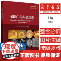 图说广角眼底影像 主编文峰 张雄泽 吉宇莹 遗传性视网膜脉络膜病变 眼底炎症与感染 视网膜血管性疾病9787117370