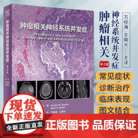 肿瘤相关神经系统并发症 第2版 翻译版 万经海 王晓光 主译 临床神经肿瘤类型治疗并发症分析肿瘤神经系统并发症 人民卫生