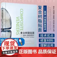 正版 复合树脂贴面 直接间接修复技术 蒋升 口腔 牙 树脂基复合材料 修复术 9787559122544 辽宁科学技